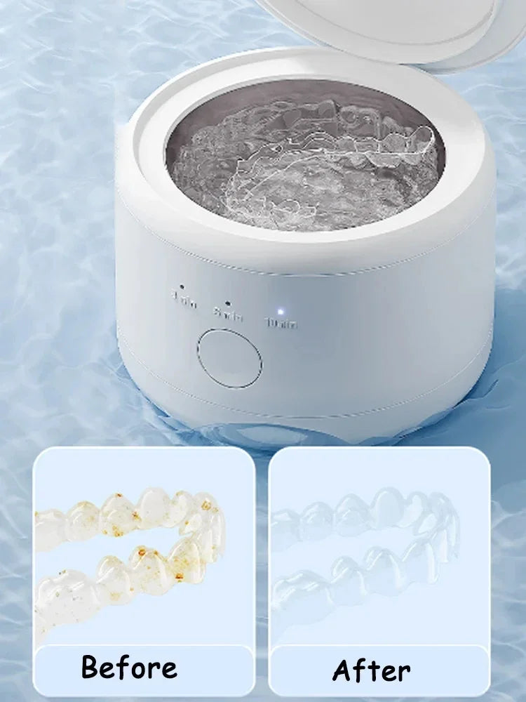 Appareil orthodontique électrique multifonction, appareil de nettoyage invisible pour prothèses dentaires, bijoux, appareil orthodontique