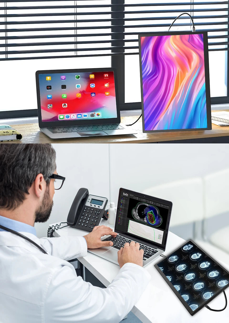 10.5" FHD 1280P Portable Monitor 100% sRGB 420nits IPS Screen w/ Dual USB-C Compatible with Mac/PC/Xbox/PS5/Switch