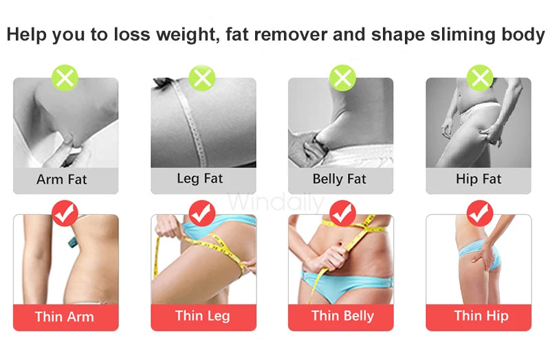 EMS+RF dual frequency lipolysis instrument intelligent slimming body shaping/LED phototherapy/fat burning massage three in one (suitable for slimming waist and legs)